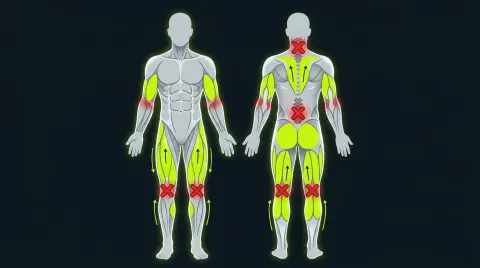 What Muscles Should You Never Foam Roll?